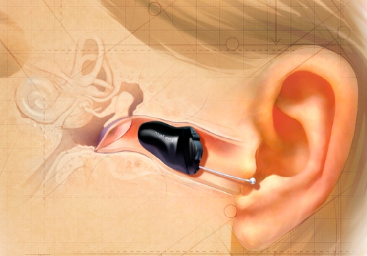 Hearing aids ever made